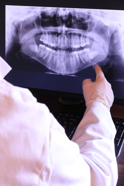 Best Chipped Tooth Repair Near Me  in Cottageville, SC