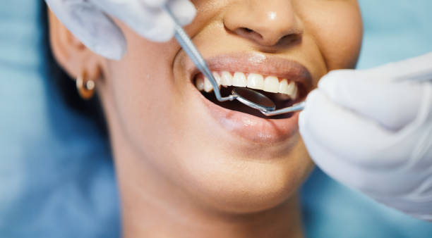 Best Chipped Tooth Repair Near Me  in Cottageville, SC